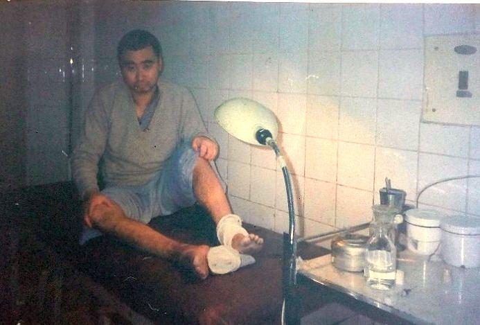 Noga gospodina Weia je teško ozlijeđena prilikom mučenja u pritvoru u oktobru 2000. godine.