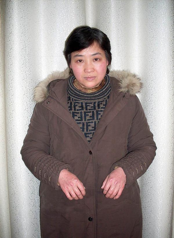 Gđa Zhang je invalid i ne može podići ruke zbog mučenja dok je bila u zatvoru. 