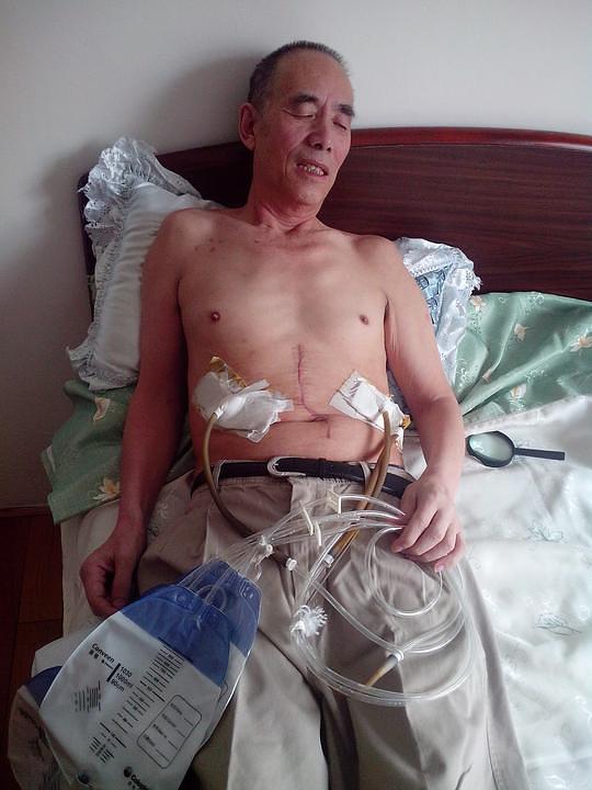 Wang Xinmin, 66,  agronom iz Mudanjianga, Heilongjiang provincija. U listopadu 2003 je bio osuđen na 14 godina zatvora. U siječnju 2014 se ozbiljno razbolio zbog mučenja u zatvoru te je dobio uvjetnu kaznu zbog narušenog zdravlja. Ipak, policija ga je , i dalje bolesnog, poslala natrag u zatvor 4. lipnja 2015. Fotografija za vrijeme uvjetne kazne. 