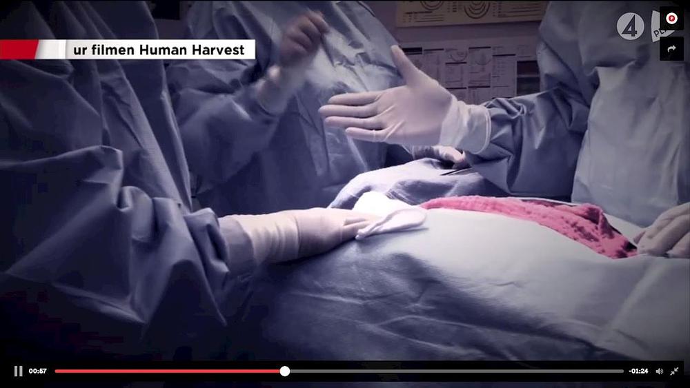Švedski televizijski kanal TV4 je također donio reportažu o prisilnom otklanjanju organa u Kini. 